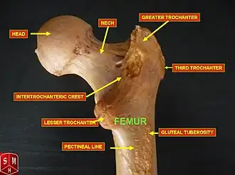 عظم الفخذ الأيمن ، صورة خلفية. المدور الثالث (بالإنجليزية: Third trochanter) موضح بأعلى يمين الصورة.