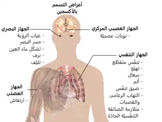 A diagraph showing a man torso and listing symptoms of oxygen toxicity: Eyes – visual field loss, near)sightedness, cataract formation, bleeding, fibrosis; Head – seizures; Muscles – twitching; Respiratory system – jerky breathing, irritation, coughing, pain, shortness of breath, tracheobronchitis, acute respiratory distress syndrome.