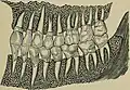 مسببات التشوهات العظمية في الرأس والوجه والفكين والأسنان (1894).