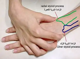 الزائدة الإبرية للكعبرة