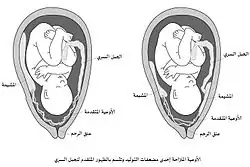 أوعية متقدمة